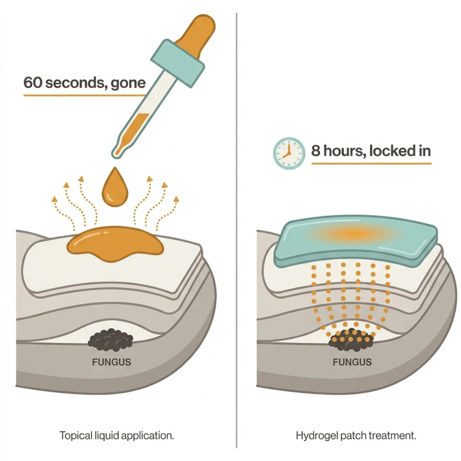 Patch on nail diagram
