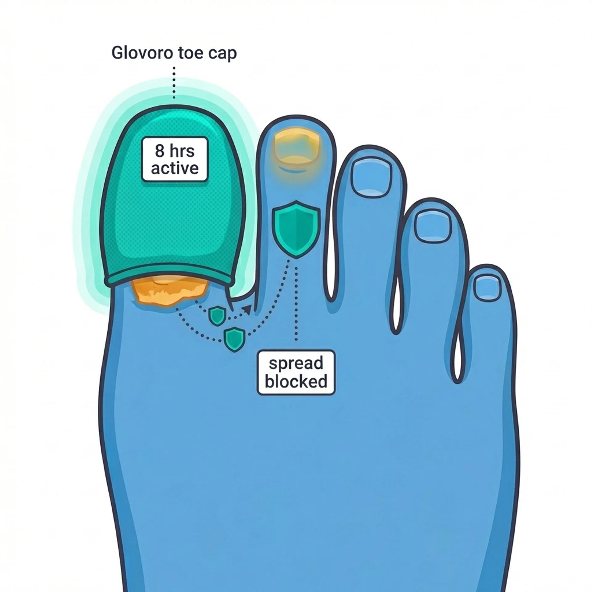 Antifungal protection