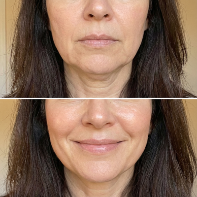 Elise L., 50